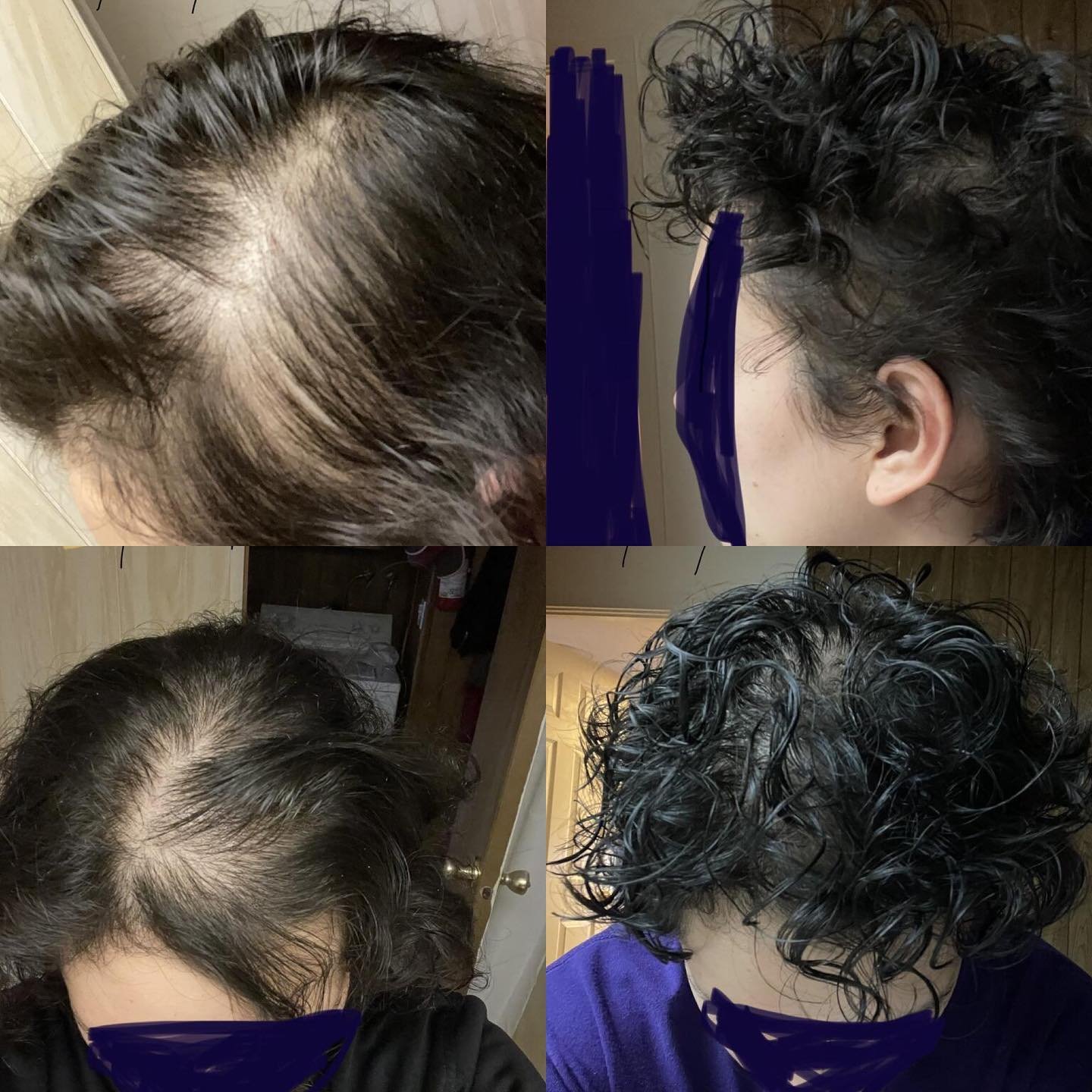 batana oil result before and after