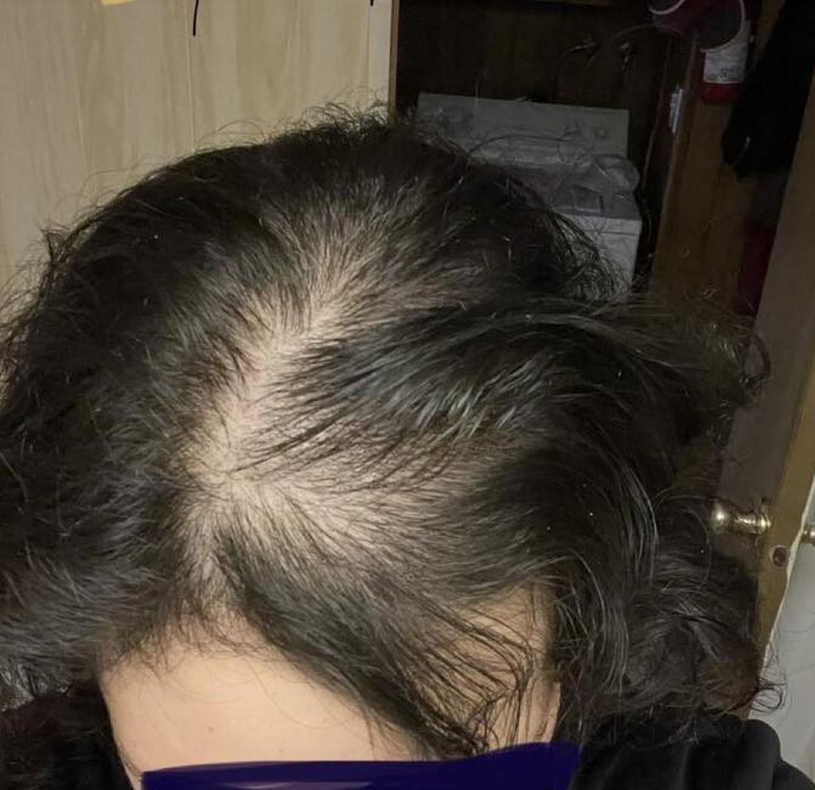 Raw Batana Oil_batana oil before and after 1+