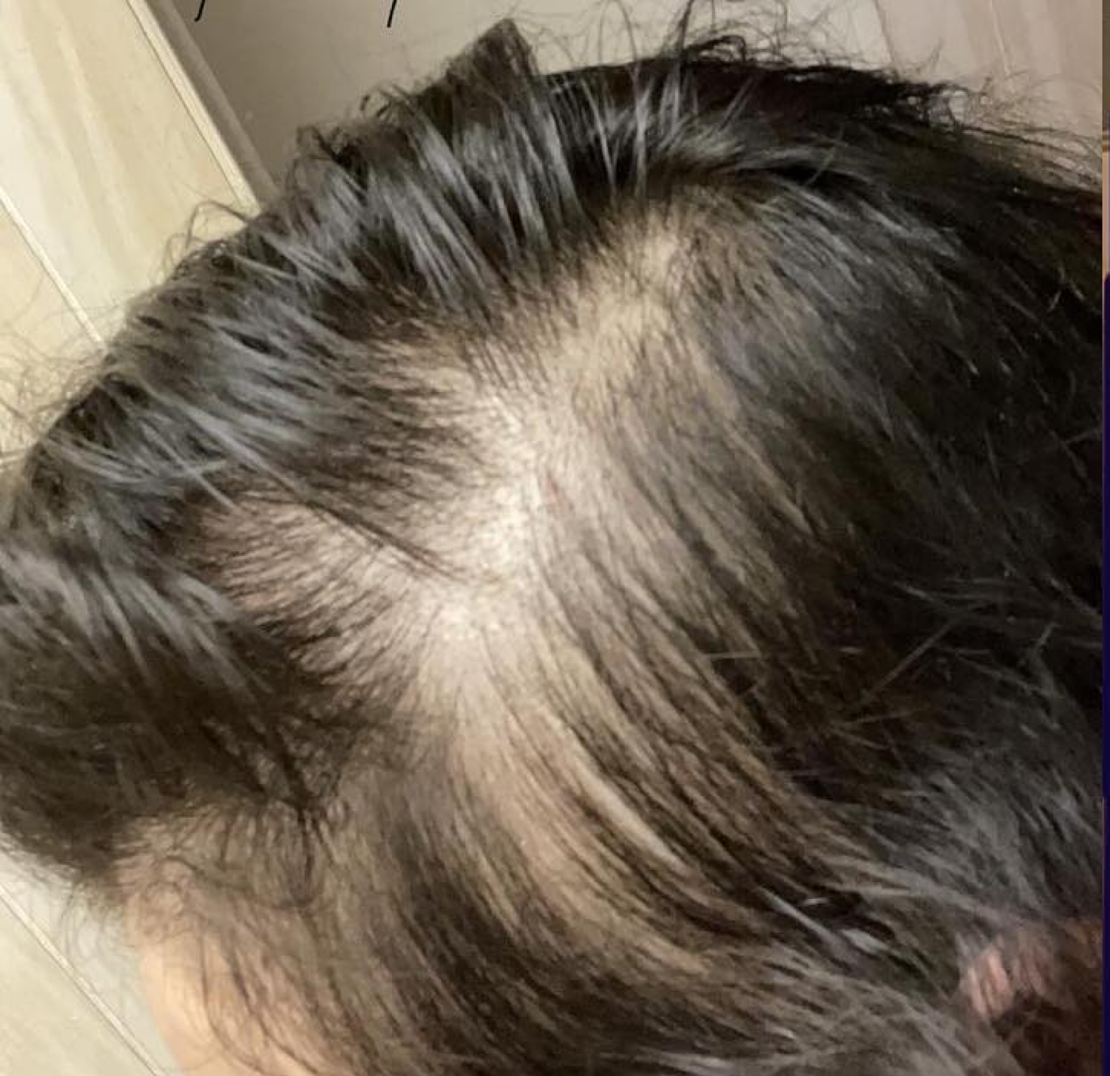 Raw Batana Oil_batana oil before and after 1