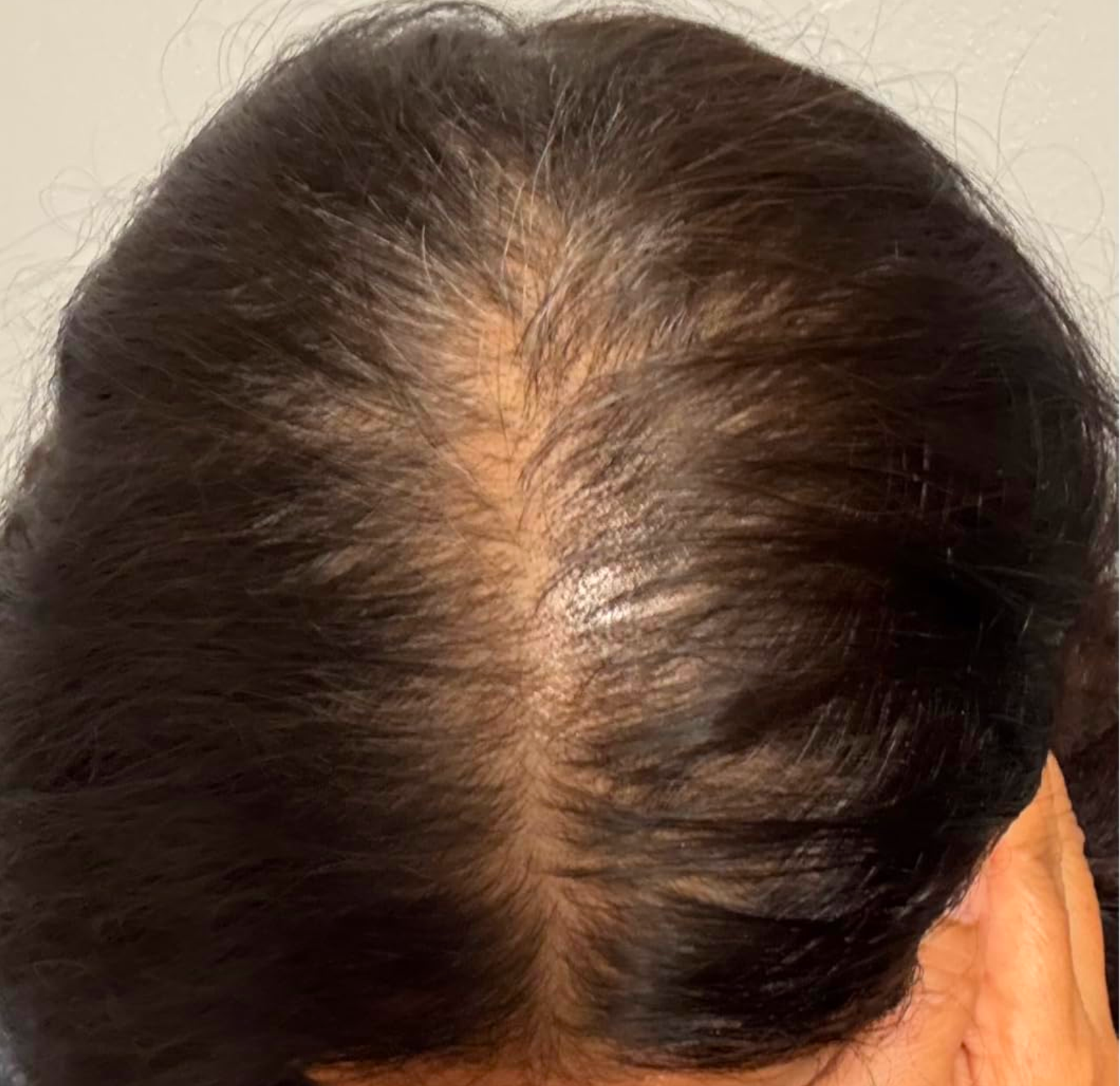 before and after raw batana oil +1