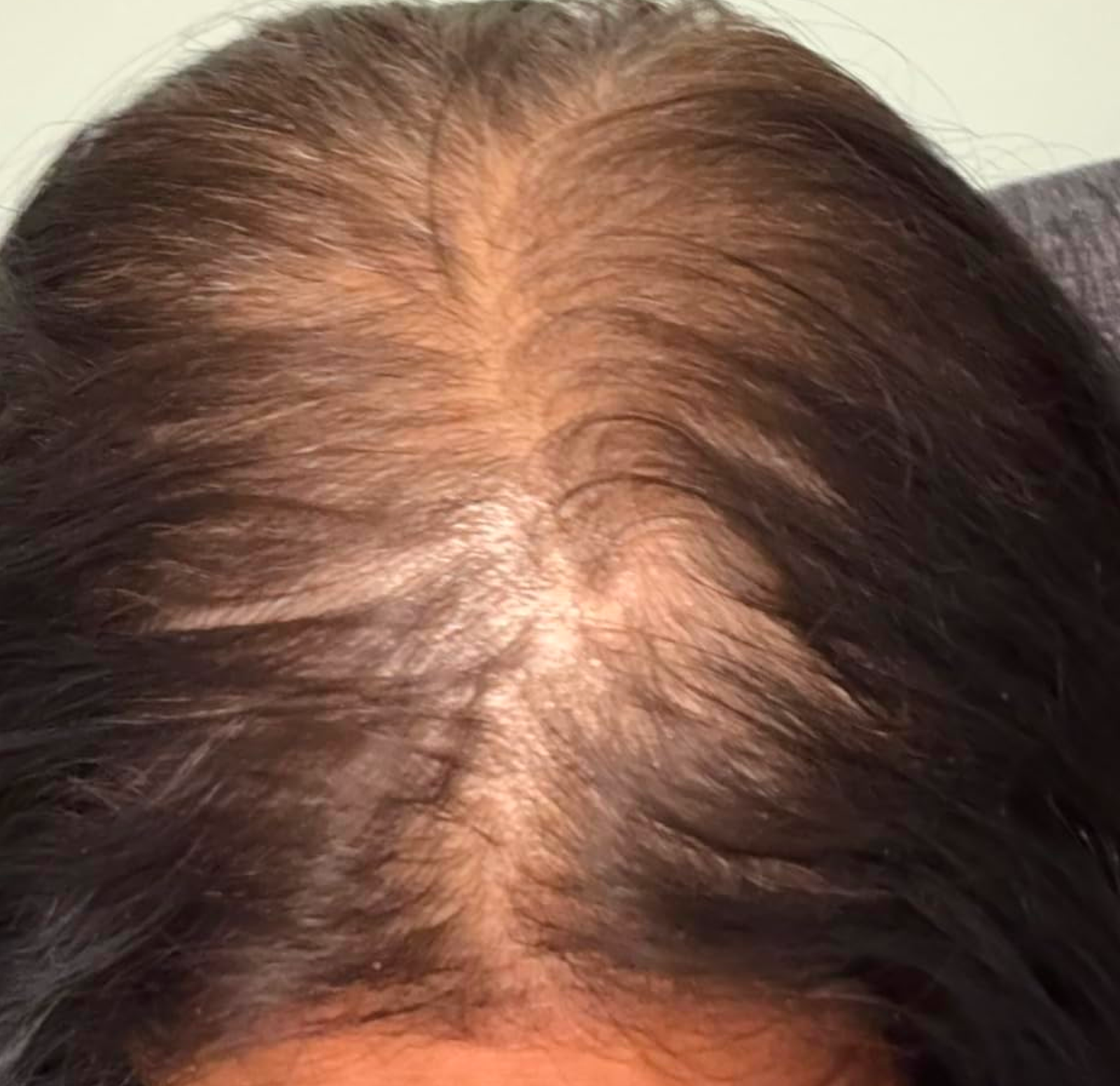 before and after raw batana oil 1