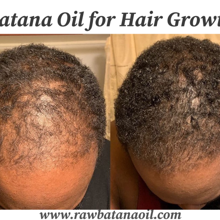 Batana Oil for Hair Growth